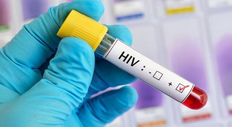 Detectan 256 casos de VIH en Hidalgo durante este 2023