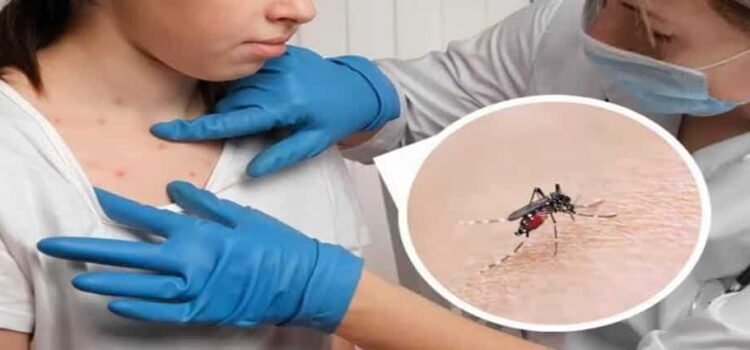 Registra Hidalgo ocho casos de dengue con signos de alarma
