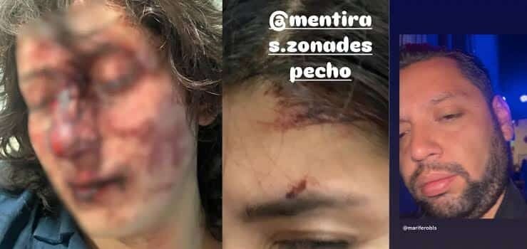 Denuncian brutal agresión en bar de Pachuca