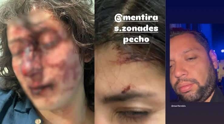 Denuncian brutal agresión en bar de Pachuca